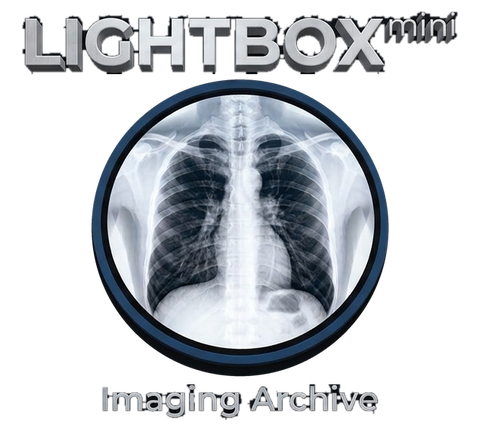 Lightbox mini — Imaging Archive